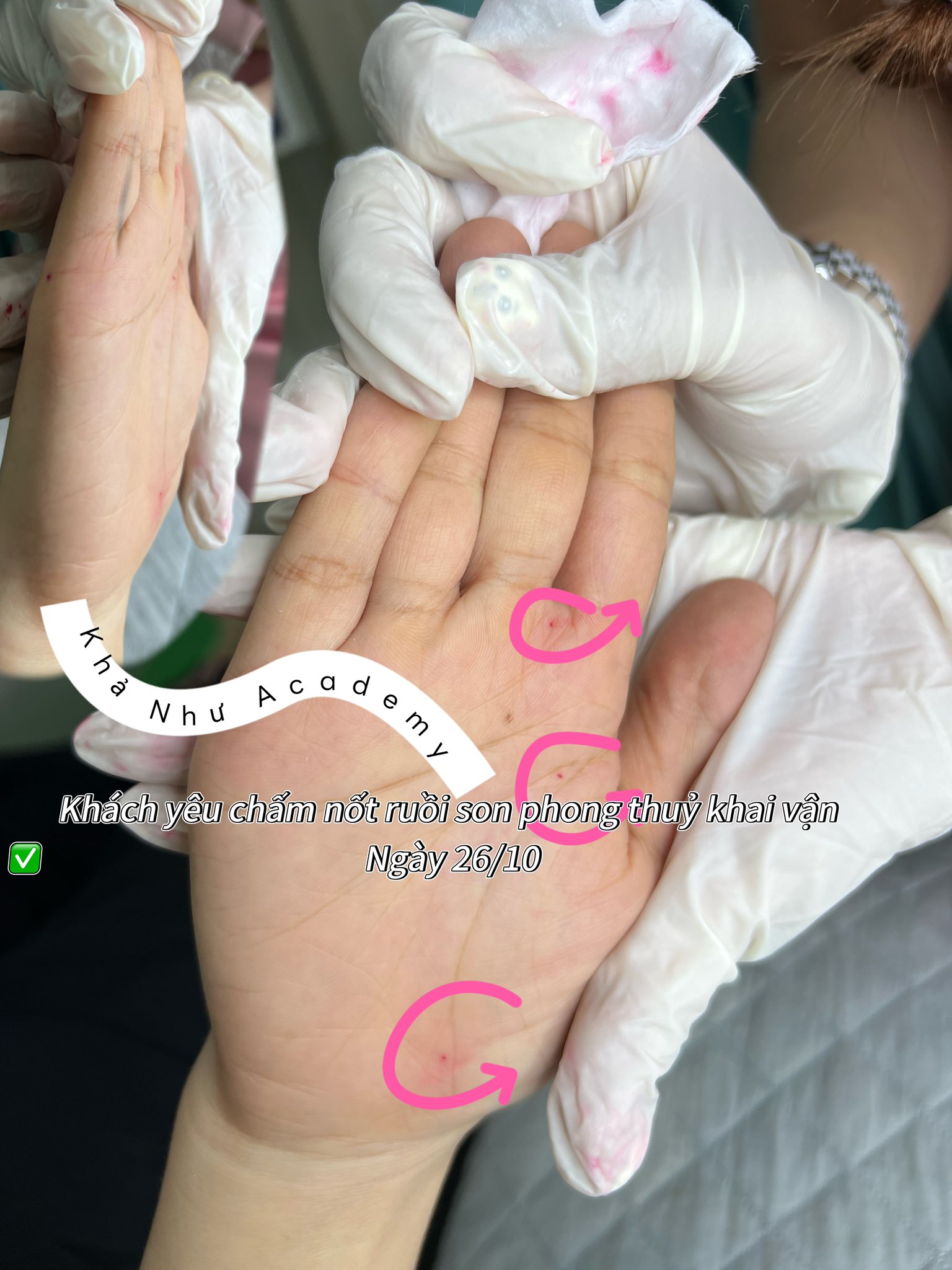 Chấm nốt ruồi son phong thủy